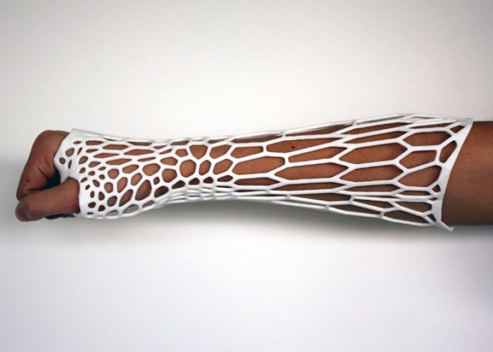 3D Printed Cast 'Exoskeletal' | Jake Evill