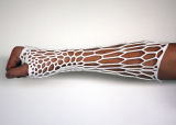 3D Printed Cast ‘Exoskeletal’ | Jake Evill